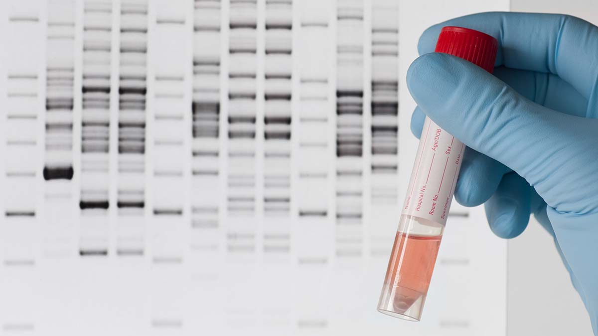 What is Western blotting/Western blot imaging?